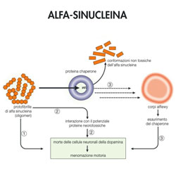 L' Alfa-sinucleina nella pelle come biomarcatore del Parkinson
